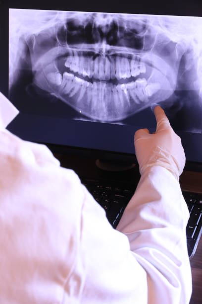 Best Emergency Treatment for Dental Infections or Abscesses in Biscoe, NC